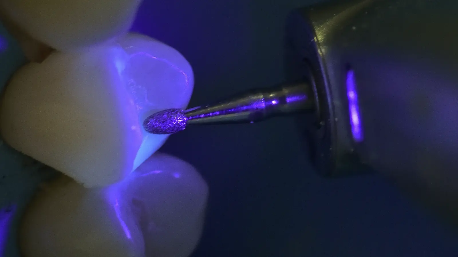 Product demonstration of blue LED illumination beside a handpiece